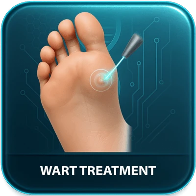 WART TREATMENT - FALLBROOK FOOT DOCTOR - YOUR FEET IN KIND HANDS WART TREATMENT - FALLBROOK FOOT DOCTOR - YOUR FEET IN KIND HANDS