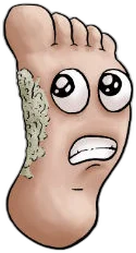 Cartoon foot with fungal skin infection