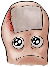 Cartoon foot with ingrown toenail