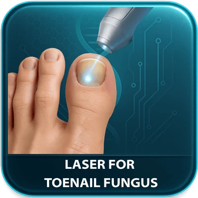 Toenail Fungus Laser