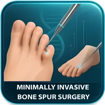 Bone Spur Removal
