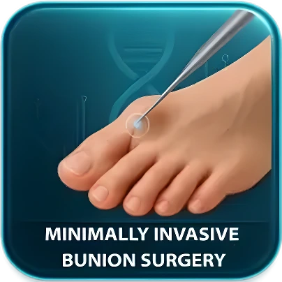 Bunion Surgery