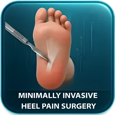 Plantar Fasciotomy