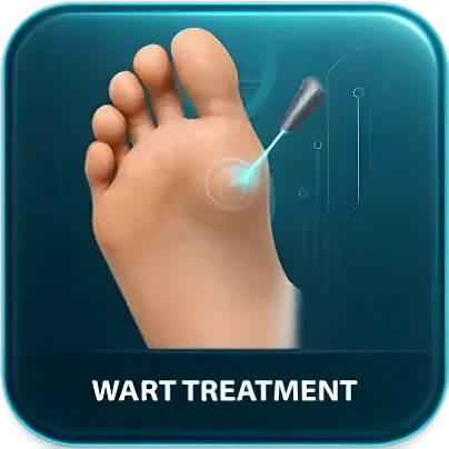 Wart Treatment