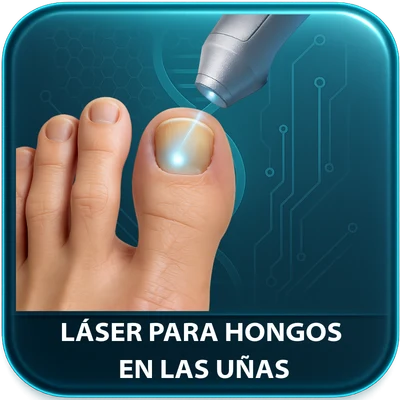 Láser para Hongos en las Uñas